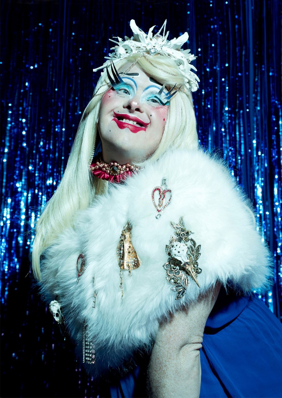 “Drag Syndrome”
